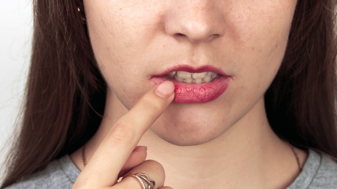 Savage Love: Am I a garbage human for not telling my boyfriend I have herpes?