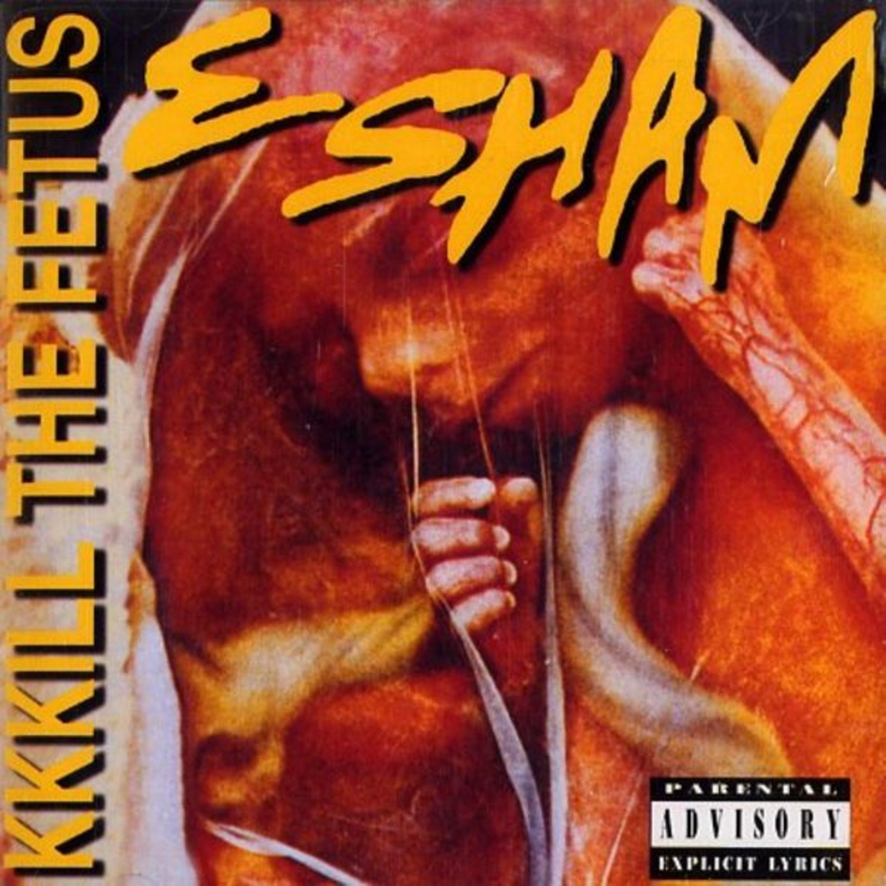 Esham
“KKKill the Fetus” 
Thanks to his psychedelic style of rapping that often centers on the subject of death, Esham is known as one of the originators of horrorcore, for better or worse. Bad taste is the norm, and this title track from his ’93 album encourages pregnant drug addicts to get an abortion rather than allow children to be raised in squalor. Hey, don’t shoot the messenger.
