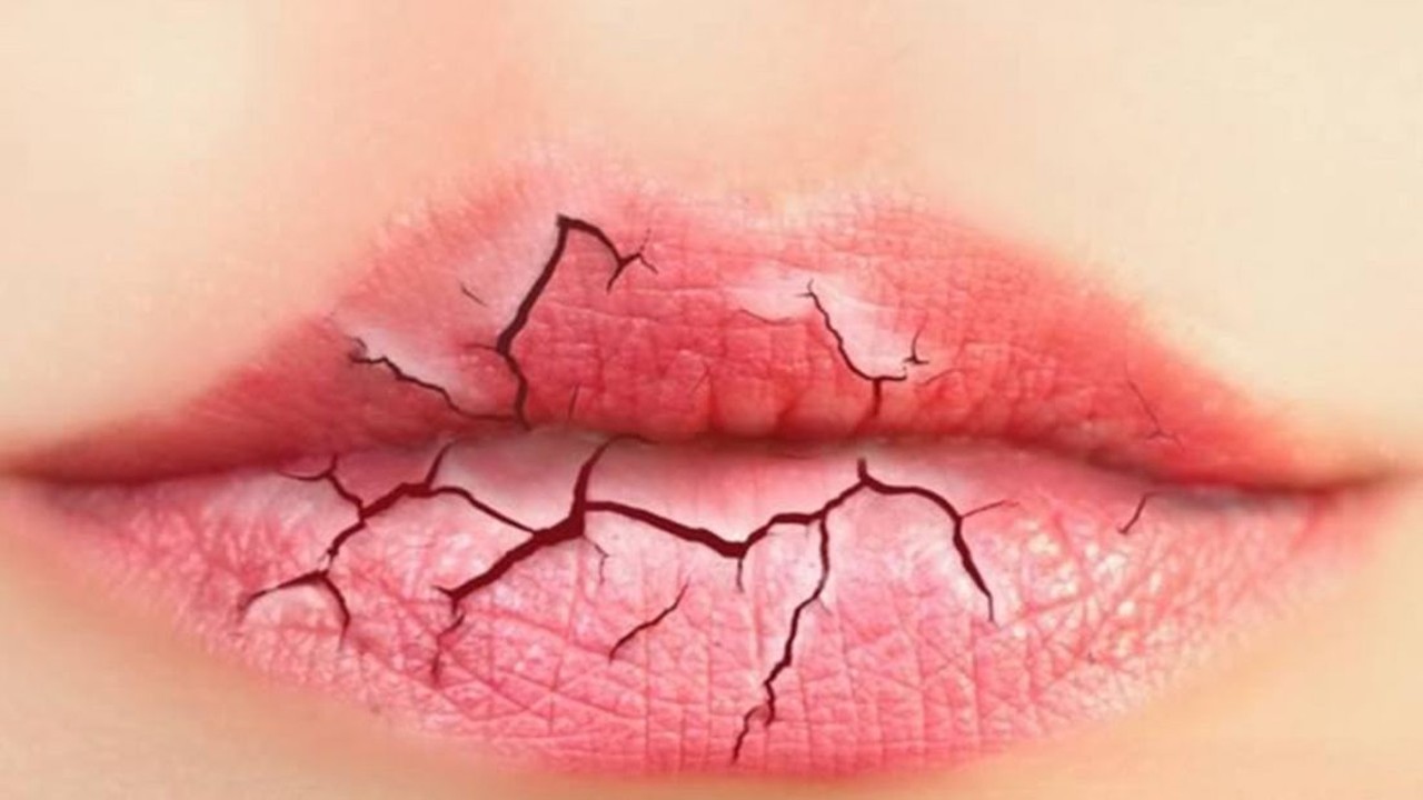  Forgetting your lip balm at home  
Cracked lips are one of the most painful and annoying symptoms of a Michigan winter, and leaving the house without that trusty tube of lip balm means dry lips for the rest of the day. 
Photo via  Home Remedies 