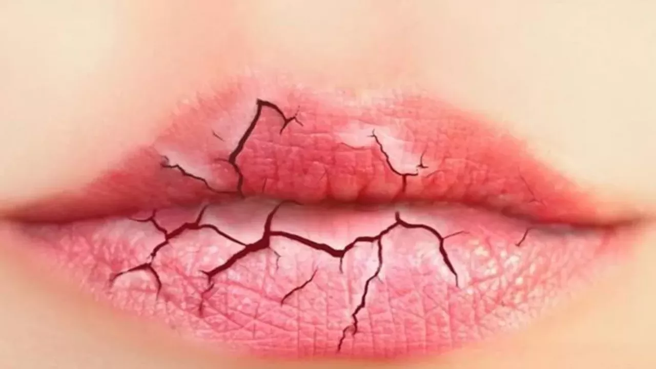  Forgetting your lip balm at home Cracked lips are one of the most painful and annoying symptoms of a Michigan winter, and leaving the house without that trusty tube of lip balm means dry lips for the rest of the day. Photo via Home Remedies 