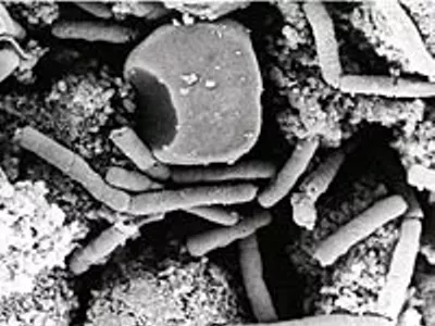Image: Anthrax anxiety