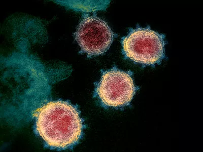This transmission electron microscope image shows SARS-CoV-2 the virus that causes COVID-19, isolated from a patient in the U.S.