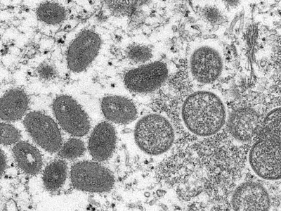 Electron microscopic image of monkeypox virion.