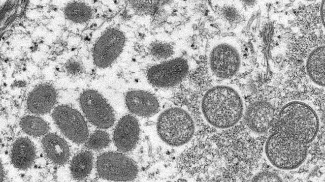 Electron microscopic image of monkeypox virion.