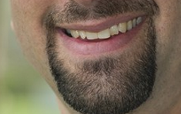 This mouth had very little to say when it was recently deposed in a civil extortion case. - MT File