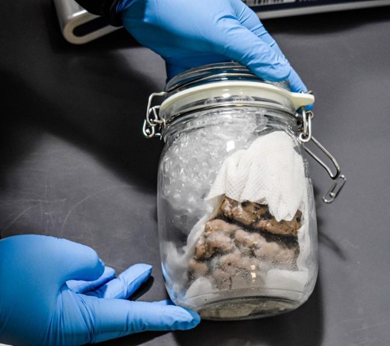 Human brain found inside a glass jar. - Customs and Border Protection