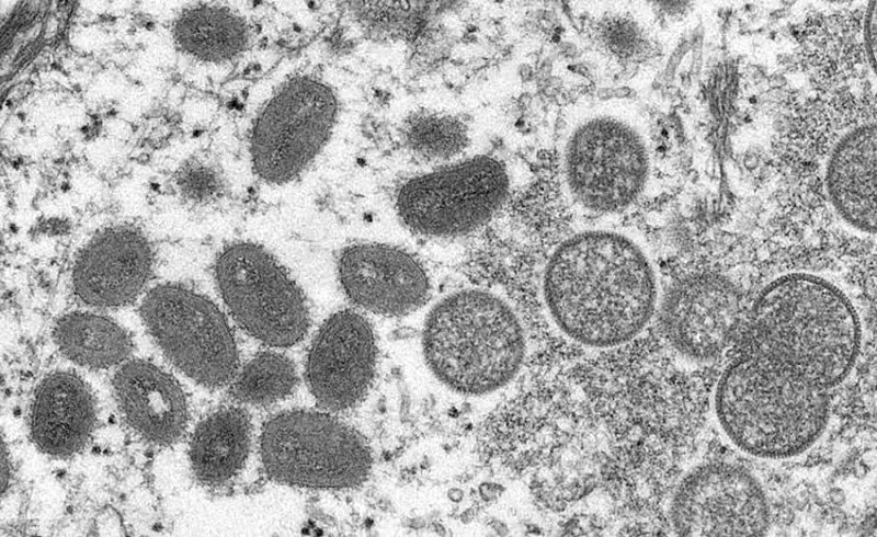 Electron microscopic image of monkeypox virion. - Cynthia S. Goldsmith, Russell Regnery